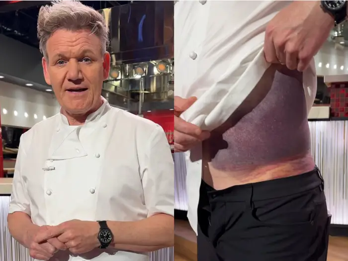 Gordon Ramsay bike accident