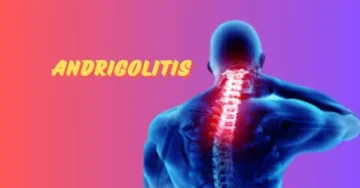 Understanding Andrigolitis: From Symptoms to Management